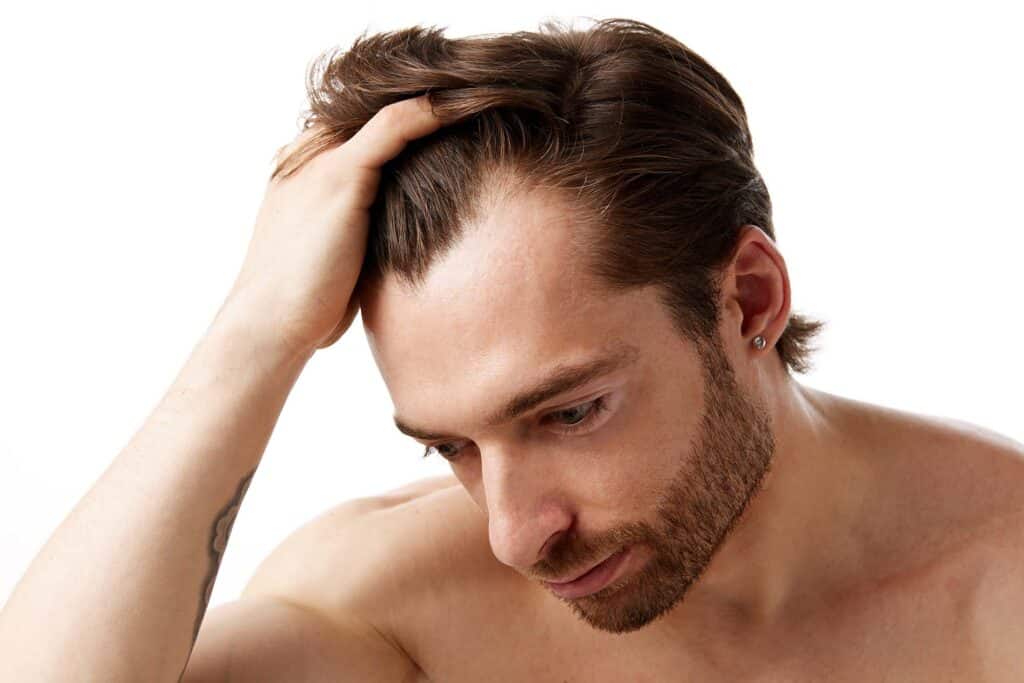 Hair Restoration image